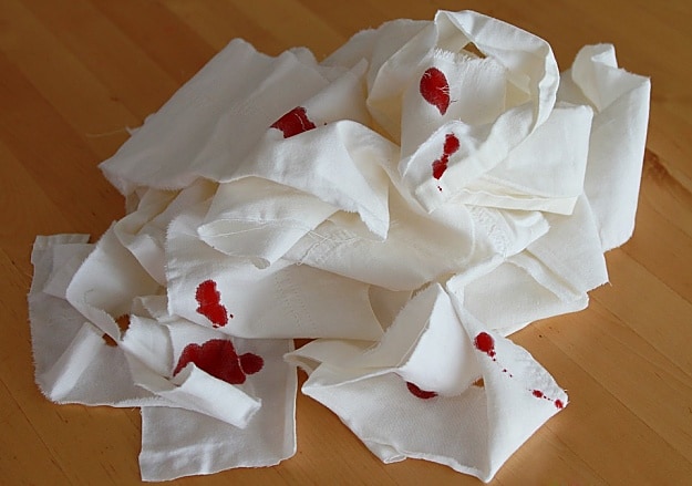Bleeding Wounds | A Basic Guide To First Aid And CPR | Homesteading Skills