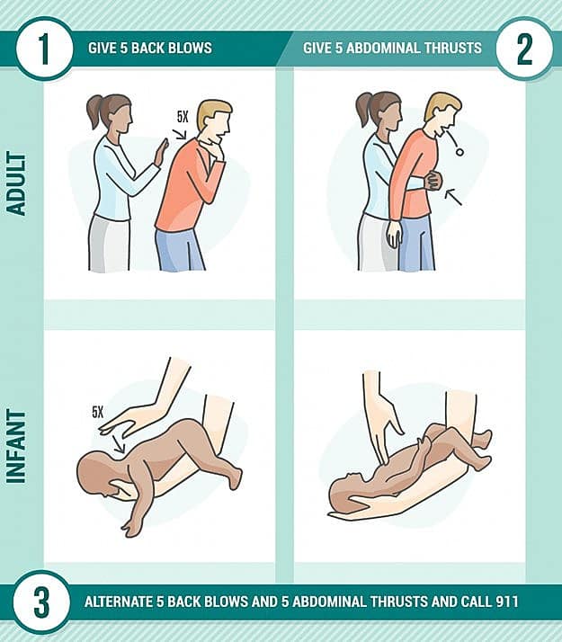 Choking | A Basic Guide To First Aid And CPR | Homesteading Skills
