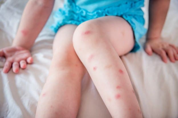 Mosquito Repellent | Incredible Uses For Tea Tree Oil Around The Homestead