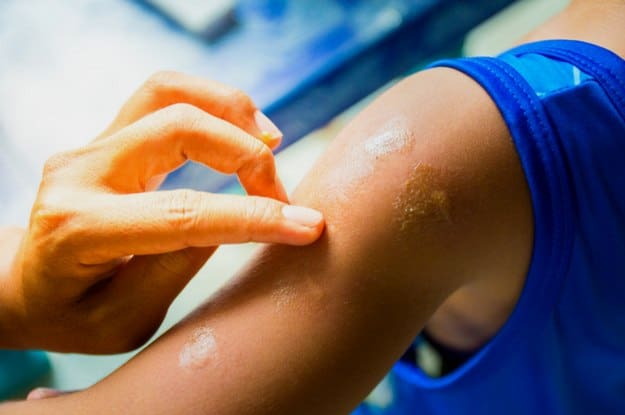 Parasitic Infection Treatment | Incredible Uses For Tea Tree Oil Around The Homestead