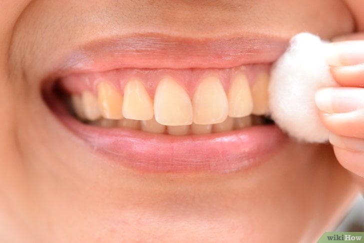 Cold Sores | Amazing Things You Could Do With Lemons We Bet You Never Knew