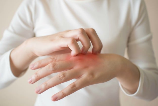 Young woman scratching her hand | Amazing Things You Could Do With Lemons We Bet You Never Knew